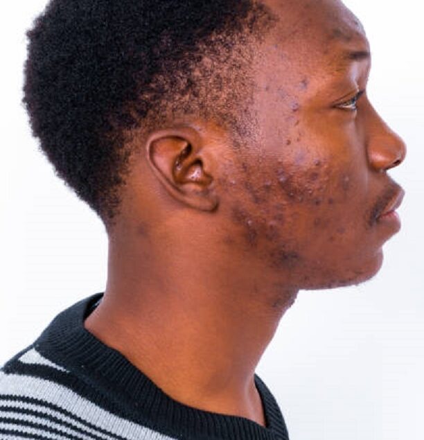 Studio Shot Of Handsome African Man Against White Background